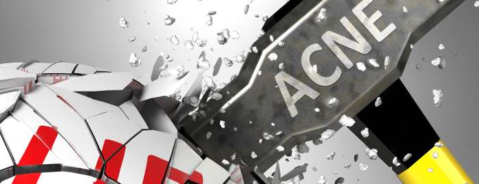 Probiotica op maat tegen acne